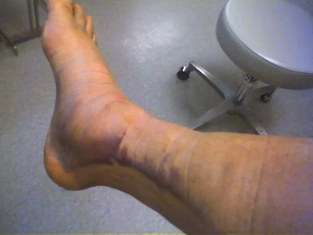 foot038_31Jan05.webp
